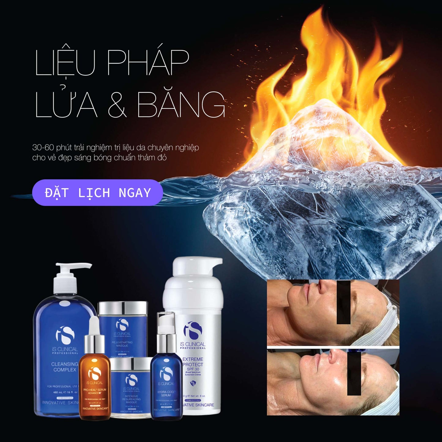 Liệu trình căng bóng da chuẩn thảm đỏ iS Clinical Fire & Ice Facial