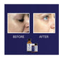 Peel da chuyên sâu giảm sắc tố và trẻ hóa da iS Clinical Prodigy Peel P2