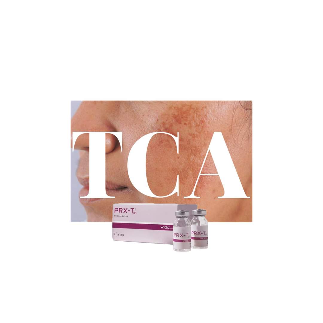 Peel da trị sẹo và trẻ hóa toàn diện WIQO PRX-T33