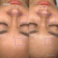 Peel da tăng cường sức khỏe làn da Skinbetter AlphaRet Professional Peel System 50