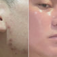 Peel da chuyên sâu cải thiện sắc tố và đảo ngược lão hóa toàn diện iS Clinical Prodigy Peel PRO P3
